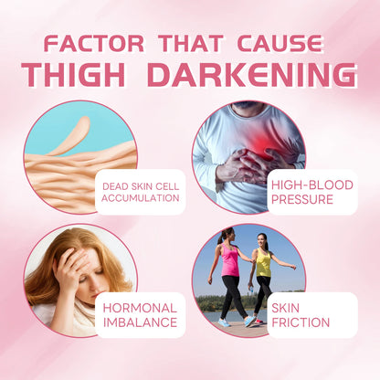 Ouhoe 100g Repair Joint Black Cream Underarm Darkness Brightening Lighten Melanin Smooth Moisturize Dry Skin Body Bleach Cream