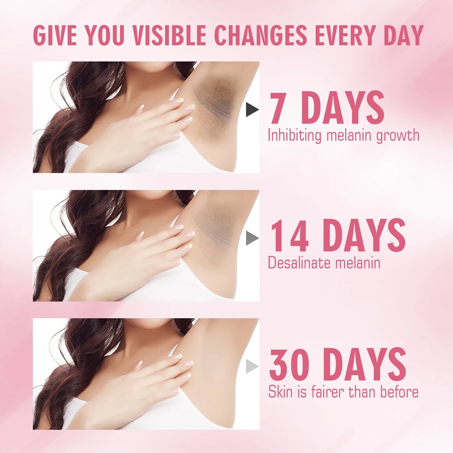 Ouhoe 100g Repair Joint Black Cream Underarm Darkness Brightening Lighten Melanin Smooth Moisturize Dry Skin Body Bleach Cream