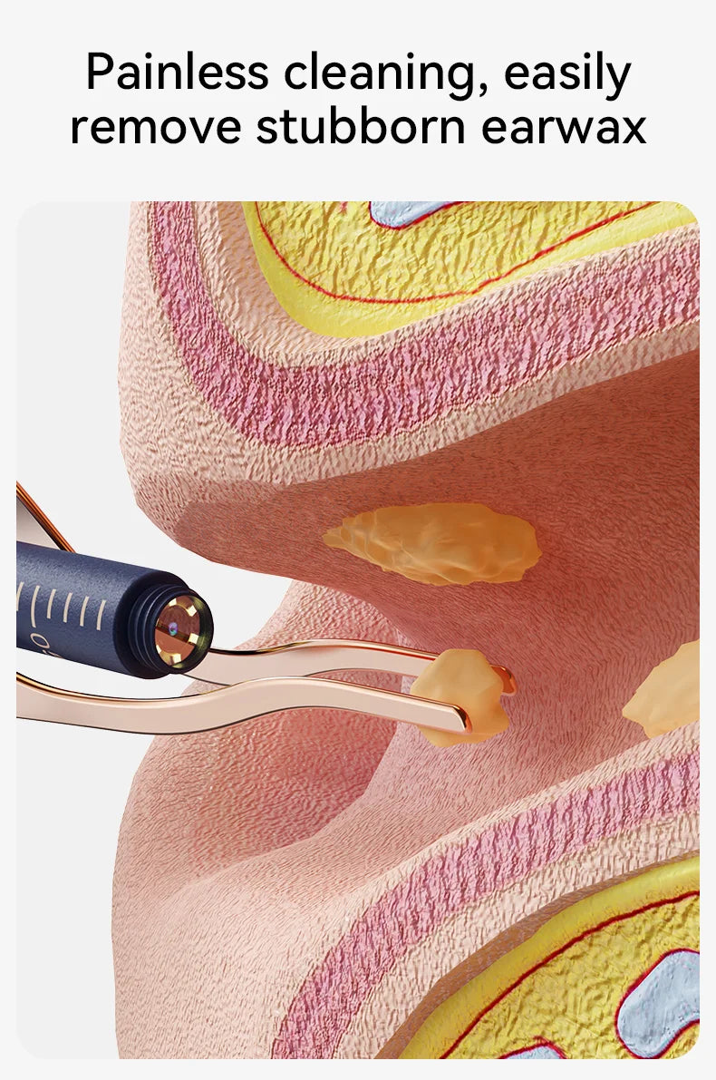 Upgraded Smart Visual Ear Wax Cleaner With Camera 800W HD Endoscope Multi-Functional Visual Ear Cleaning Tool Includes Storage