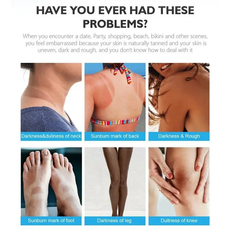 Whitening Cream For Dark Skin Underarm Bleaching Armpit Lightening And Intimate Area Woman Moisturizer Korean Skin Care Products