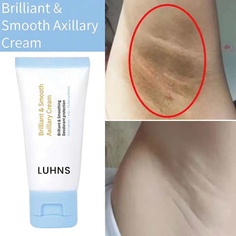 Whitening Cream For Dark Skin Underarm Bleaching Armpit Lightening And Intimate Area Woman Moisturizer Korean Skin Care Products