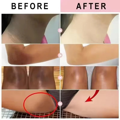 Whitening Cream For Dark Skin Underarm Bleaching Armpit Lightening And Intimate Area Woman Moisturizer Korean Skin Care Products