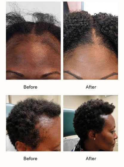 Fast Hair Growth Oil African Crazy Chebe Hair Oil Traction Alopecia Treatment Oil Natural Crazy Hair Regrowth Anti Hair Care