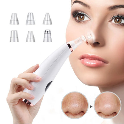 Electric Blackhead Remover Vacuum Pore Cleaner for Deep Facial Cleansing